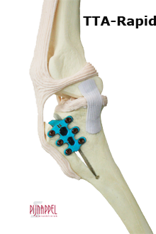 tuberositas tibiae advancement volgens de nieuwe methode: minder belastend, minder complicaties TTA-Rapid